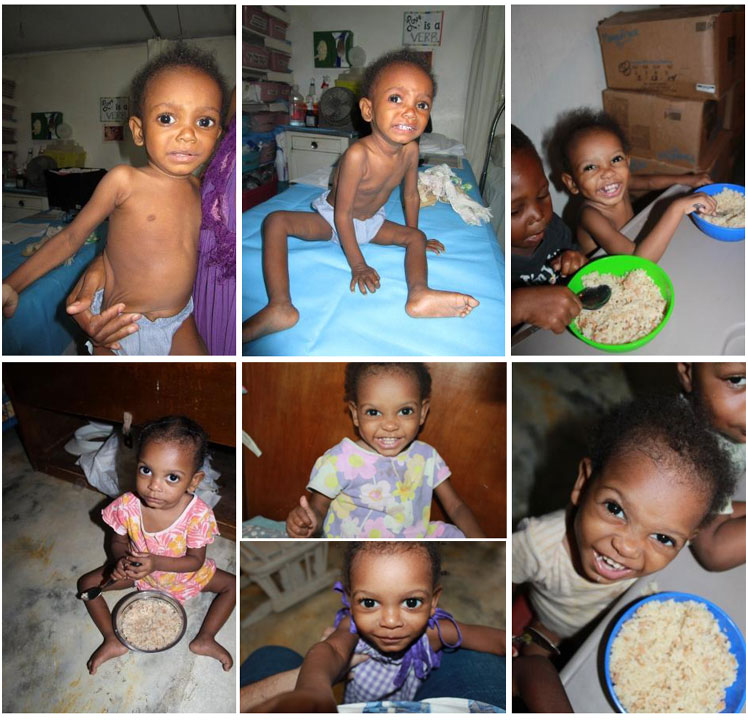 Marie Esther is just one of the hundreds of children whose lives have been saved 02-20-2015 – 8:27 AM