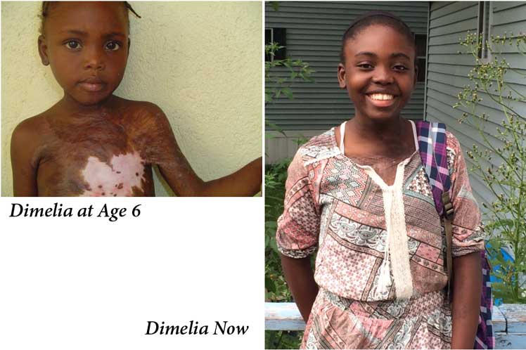 Dimelia’s Story: 6-5-2015 4:00 PM