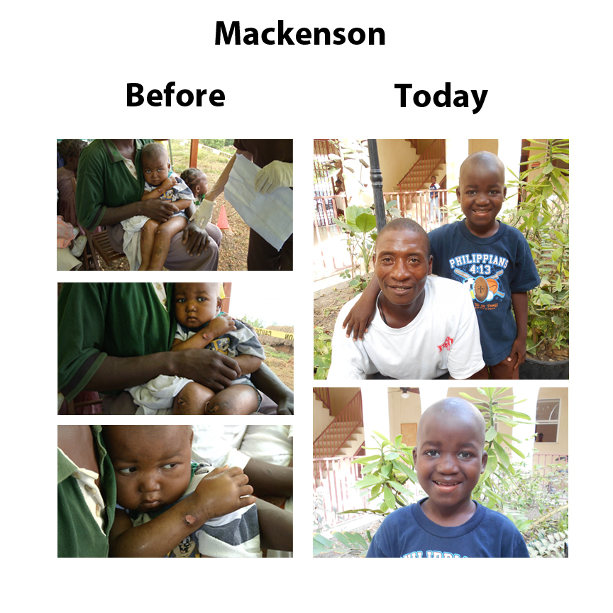 Mackenson – 07-08-15