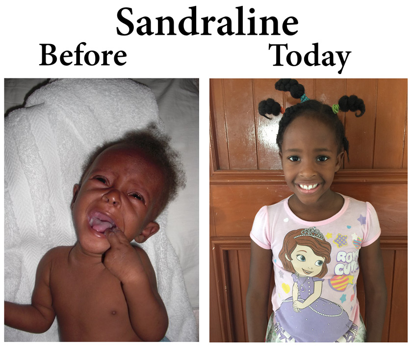 Update on Sandraline: 2-14-16  5:00 PM