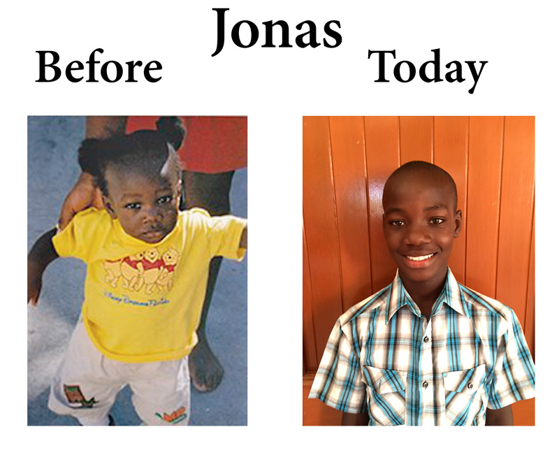 Update on Jonas - 2016 - Love A Child