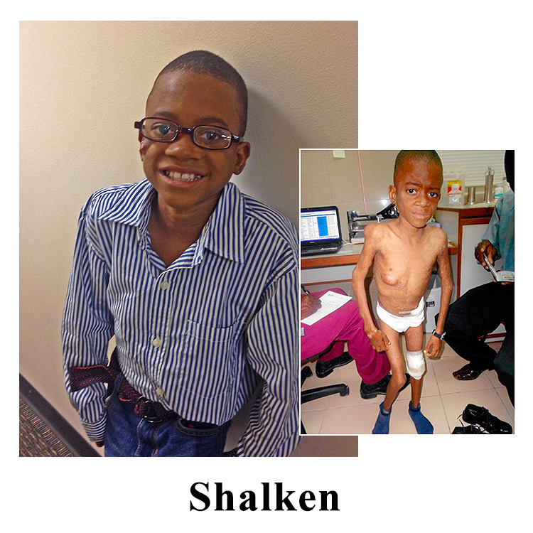 Helping Shalken – Update From Haiti