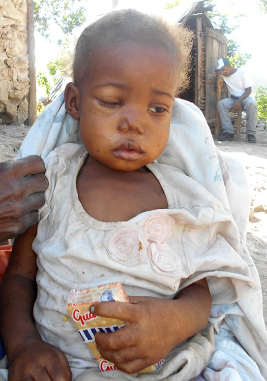 Haiti's children are dying every day.