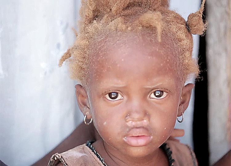 Widespread malnutrition throughout Haiti.