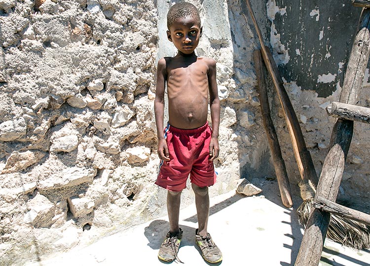 Young boy starving to death