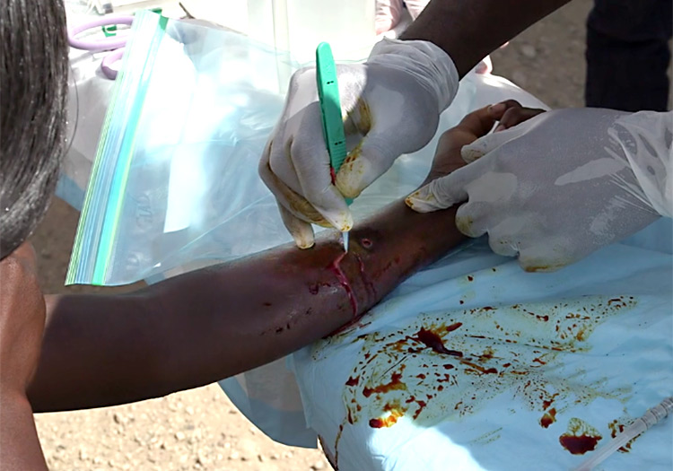 Minmor surgery on Haitian woman's arm.