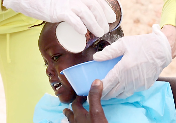 Mobile Medical Clinic-Young girl receives wound cleaning and washing for the skin infections.