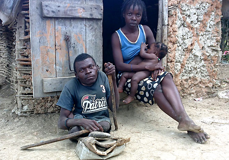 Father of family with crippling disability. Extraordinary Challenges for those with Special Needs in Haiti.