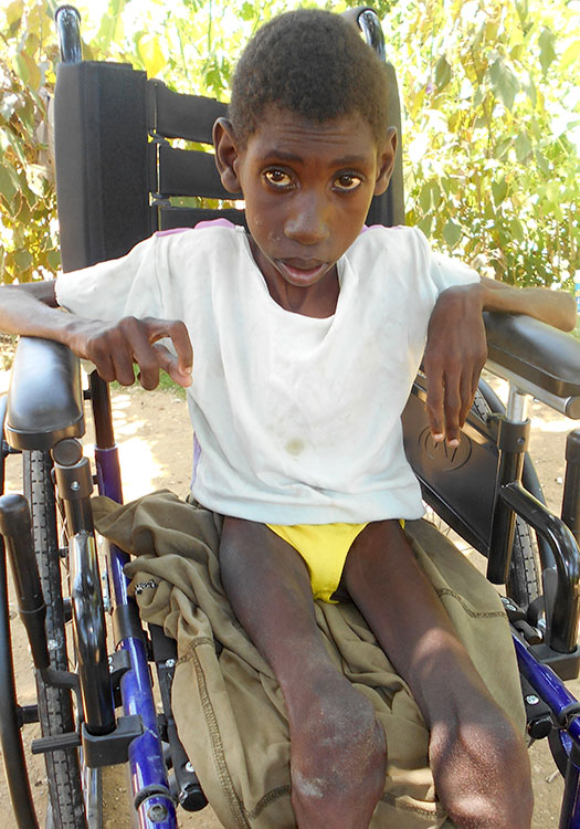 Janel at Sapaterre disabled and severe malnutrition.