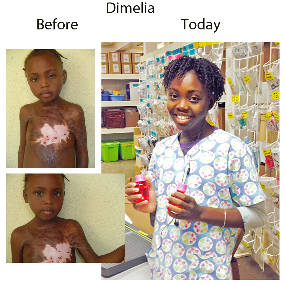 Dimelia Update – 06-13-16