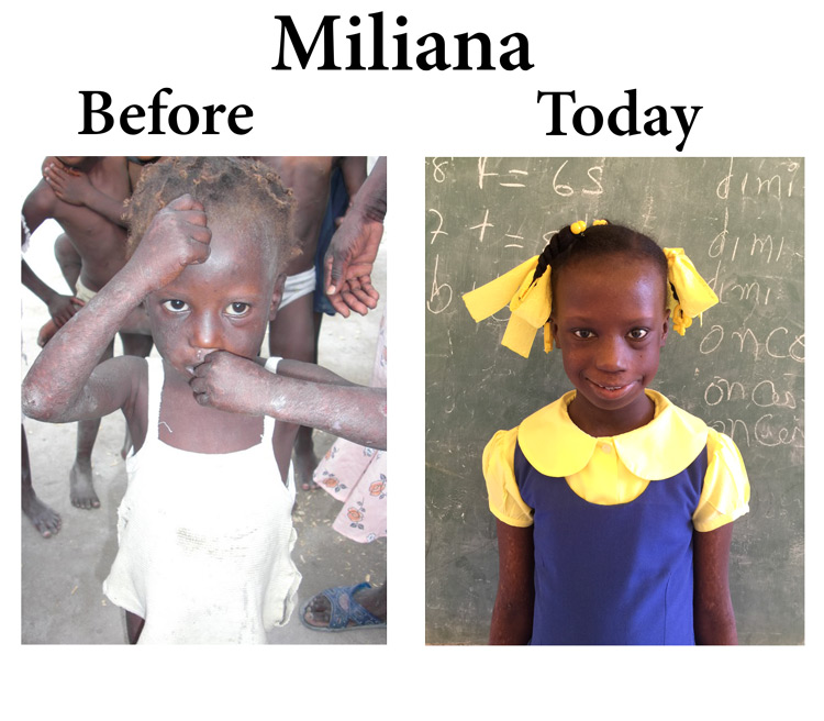 Miliana needs a Medical Visa: 6-21-16  11:15 AM