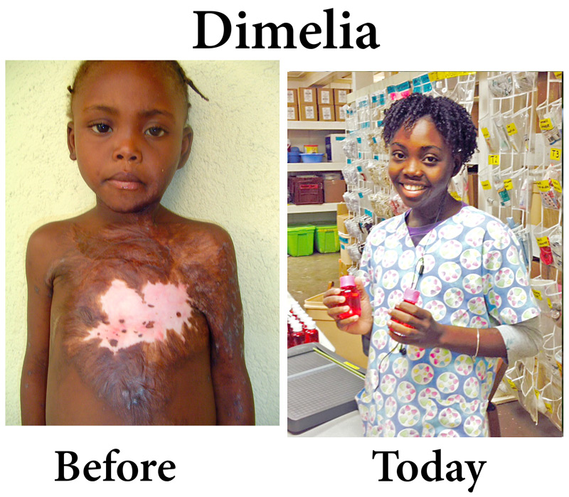 Update on Dimelia’s upcoming surgeries:  6-7-16  1:00 PM