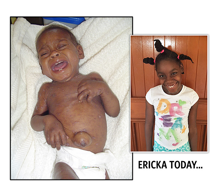 Update on Ericka – Love A Child Orphanage