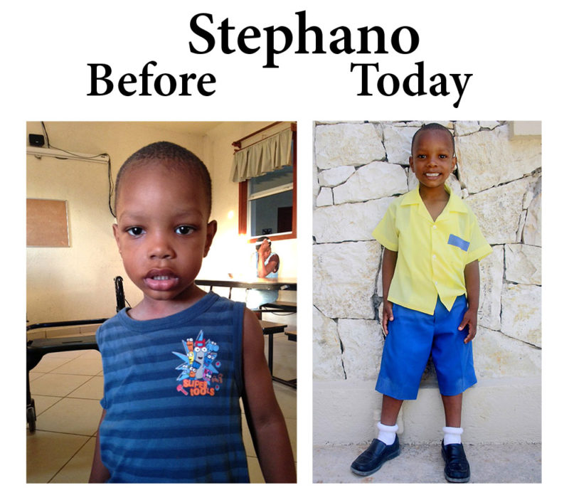 Update on Stephano:  2-4-17  7:30 PM