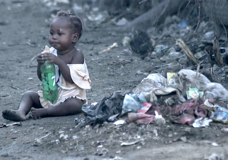 Malnourished child sitting at Truttier Dump site in Haiti.
