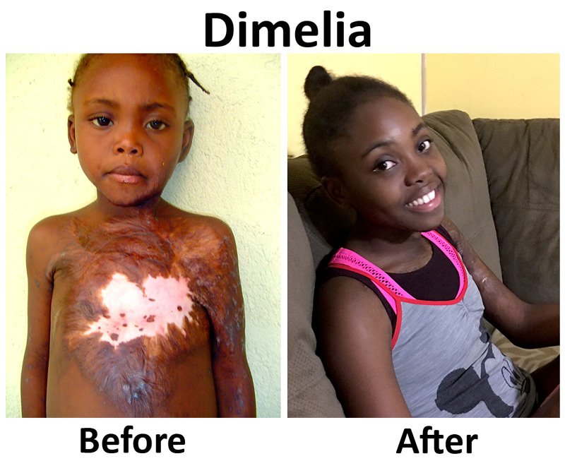 Update on Dimelia:  9-9-16  8:20 AM