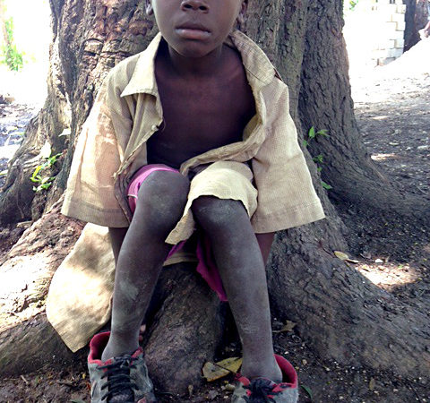 Judley from a poor village in Haiti