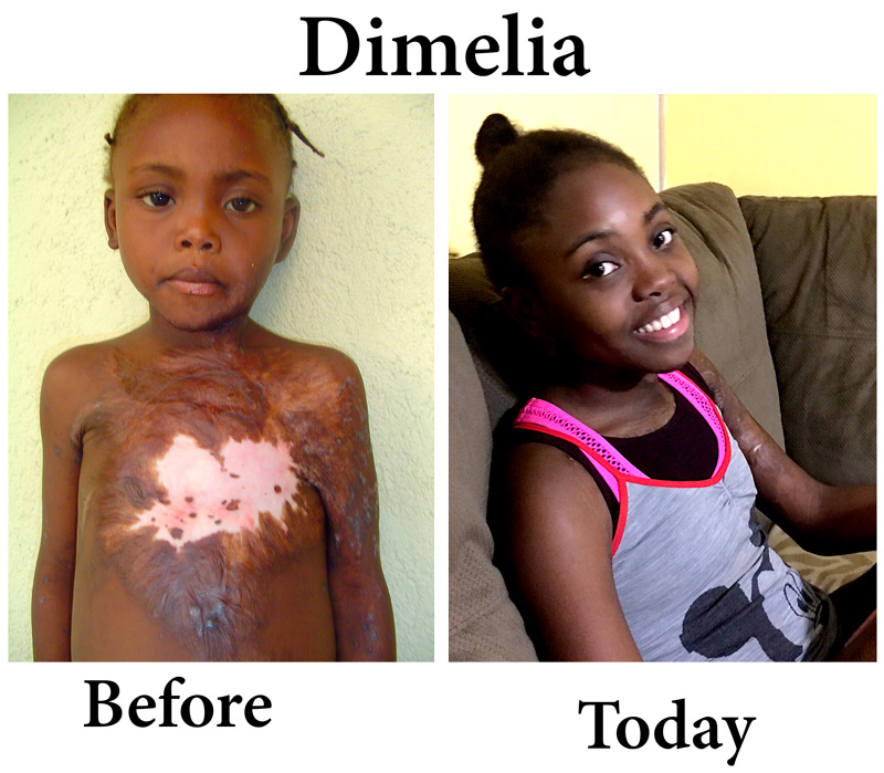 Update on Dimelia:  9-28-16  8:00 AM