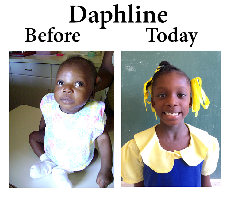 Update on our Love A Child Orphan Daphline: 2-18-17  7:15 PM