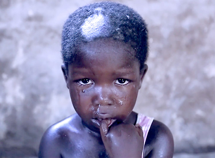 Starving child in Haiti