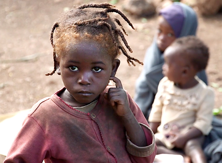 Children with malnutrition