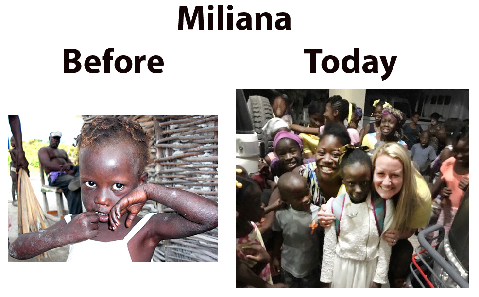 Miliana returns to Haiti – 01-31-17