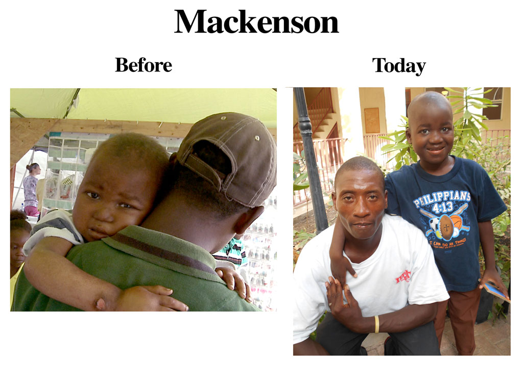 Update on Mackenson 2-7-17  10:30 AM