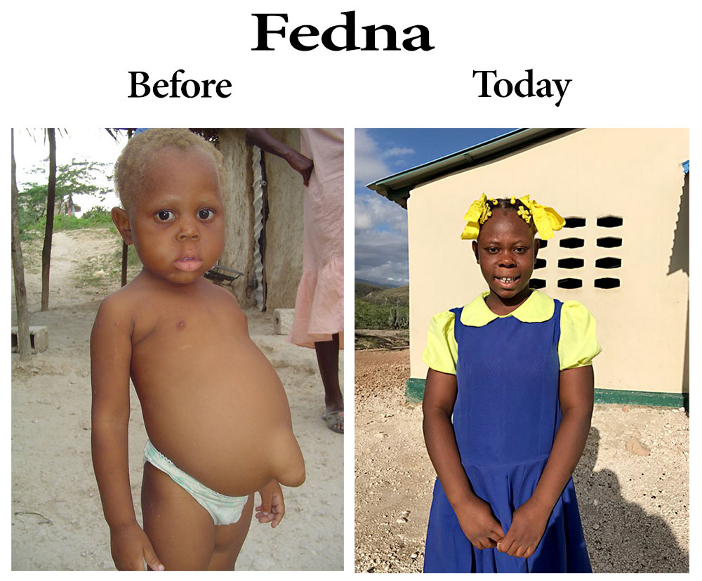 Look what Child Sponsorship can do:  3-7-17  5:00 PM