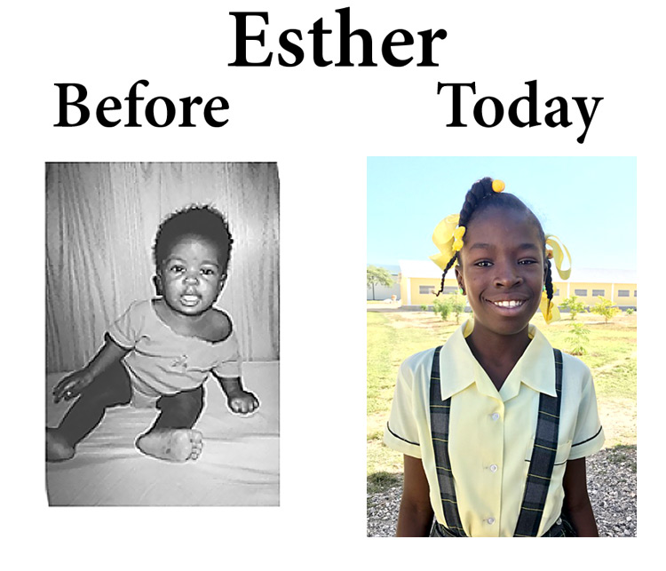 Update on Esther Louis: 8-6-17  6:00 PM