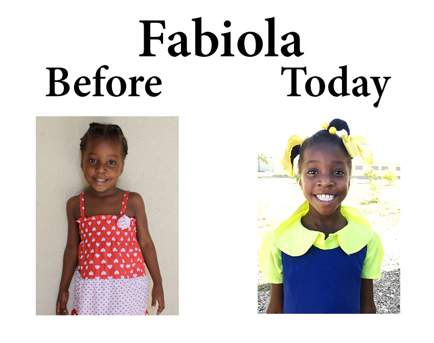 Update on Fabiola:  5-13-17  8:00 PM