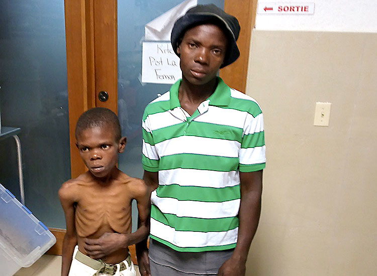 Child died from severe malnutrition.