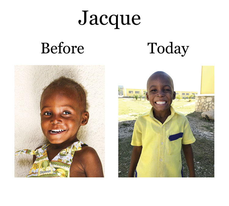 Update on Jacque:  11-26-17  8:00 PM