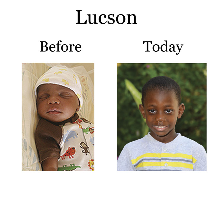 Update on Lucson: 11-4-17  7:00 PM