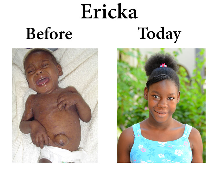 Update on Ericka:  9-28-17  6:30 PM