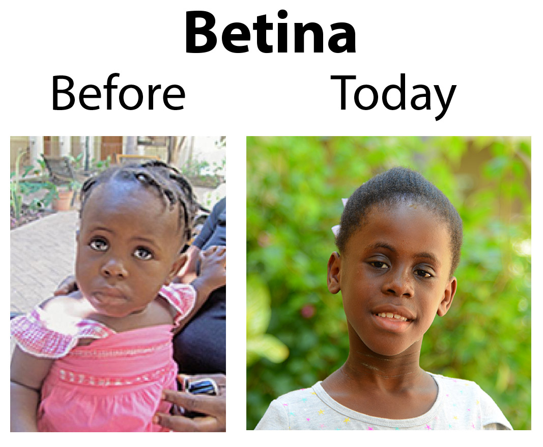 Betina Update – 11-28-17