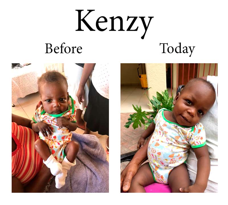 Update on Kenzy:  11-1-17  12:05 PM