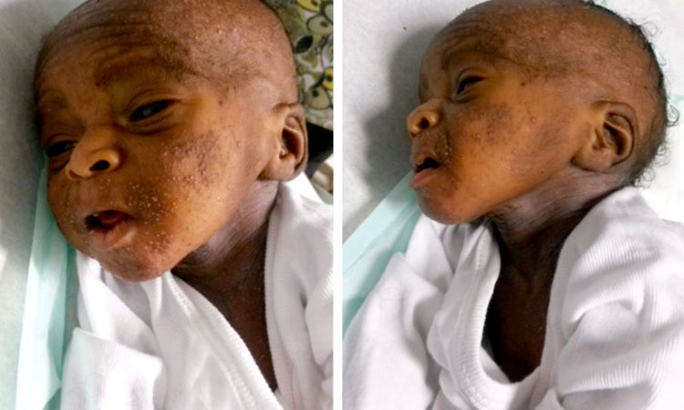 Neglected child brought to our Jesus Healing Center