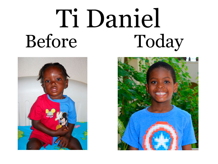 Update on Ti Daniel:  12-31-17  7:45 PM