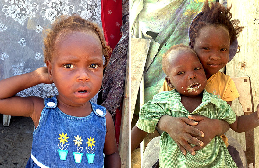 A few of the children that are tortured with malnutrition.