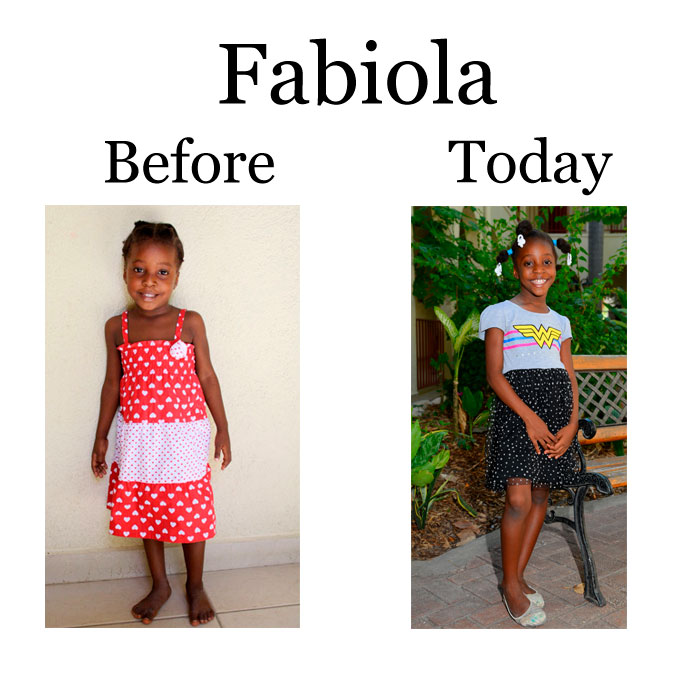 Update on Fabiola: 1-21-18  7:00 PM