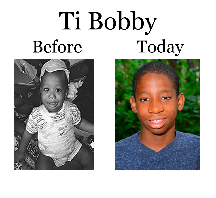 Update on Ti Bobby: