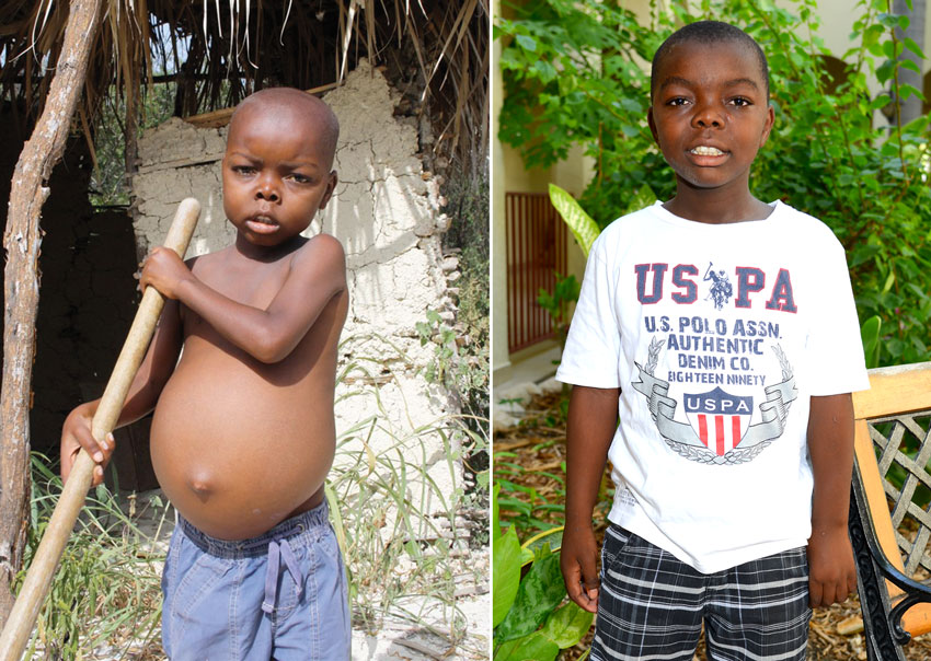 Haitian children do not receive routine healthcare, and many have worms, impetigo and a multitude of other conditions that are symptoms of malnutrition.
