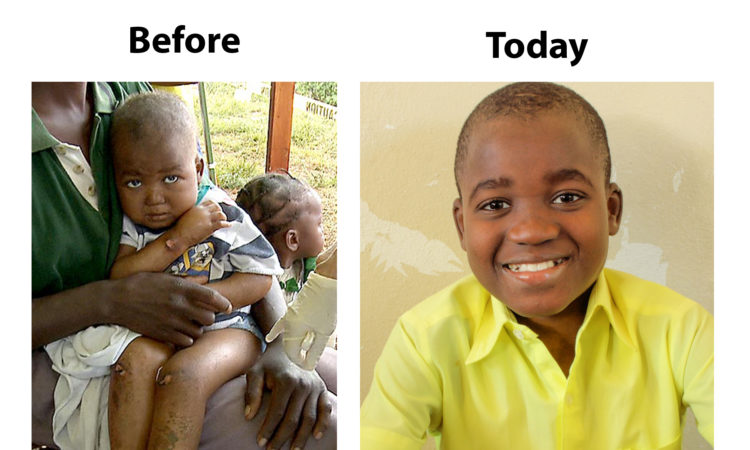 Mackenson Before and Today