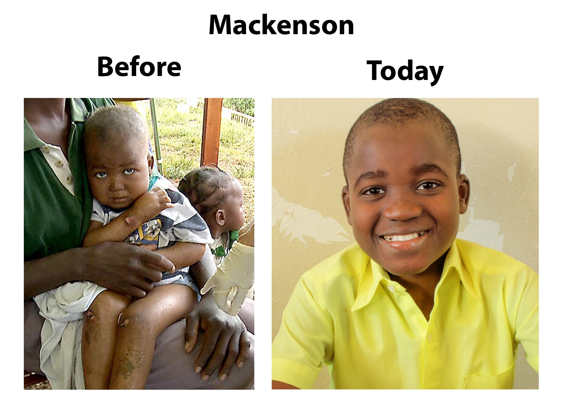 Mackenson Before and Today – 02-19-18