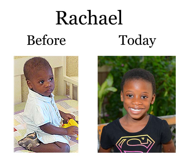 Update on Rachael Louis:  4-7-18  7:10 PM