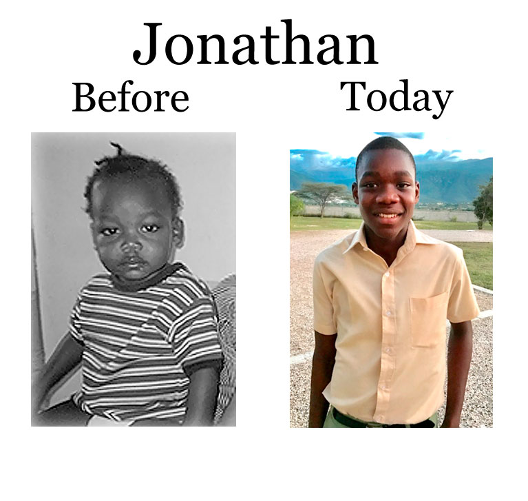 Update on Jonathan: 4-8-18   6:45 PM