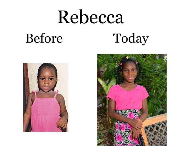 Update on Rebecca:  3-17-18  6:30 PM