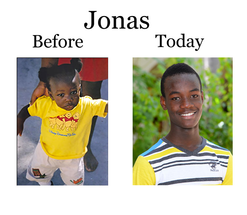 Update on Jonas