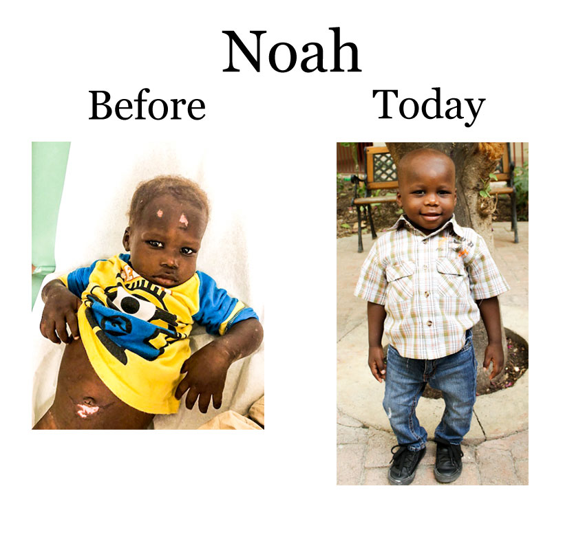 UPDATE ON LITTLE NOAH