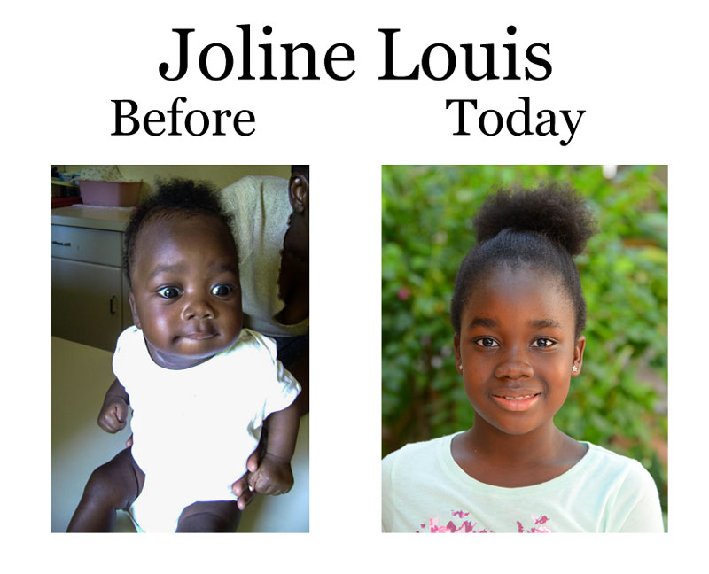 Update on Jolina Louis